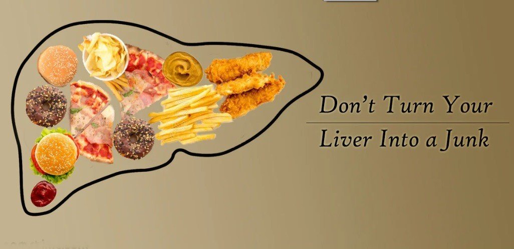 Fatty Liver Diagnosis
