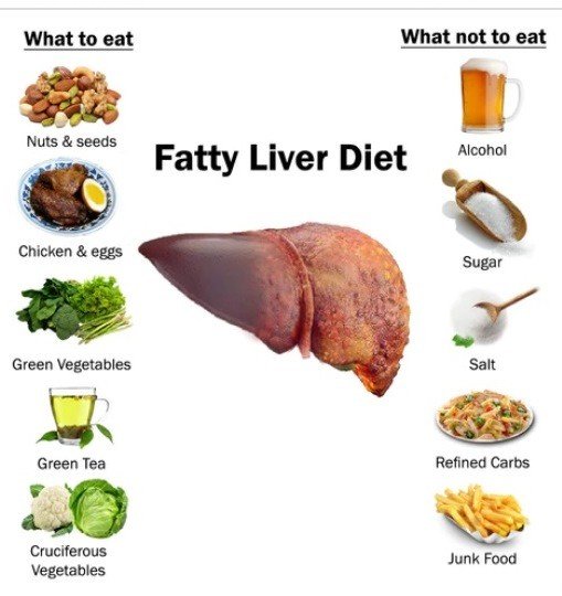 Fatty Liver Diet